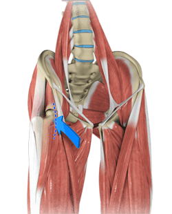  Anterior Hip Replacement 
