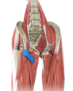 Anterior Hip Replacement